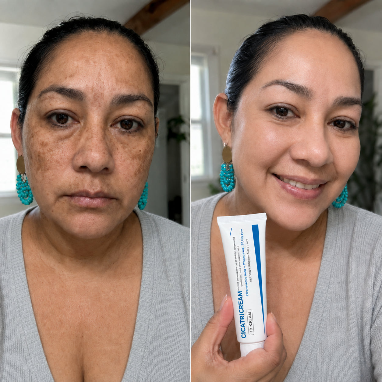Cicatricream — corrector de manchas