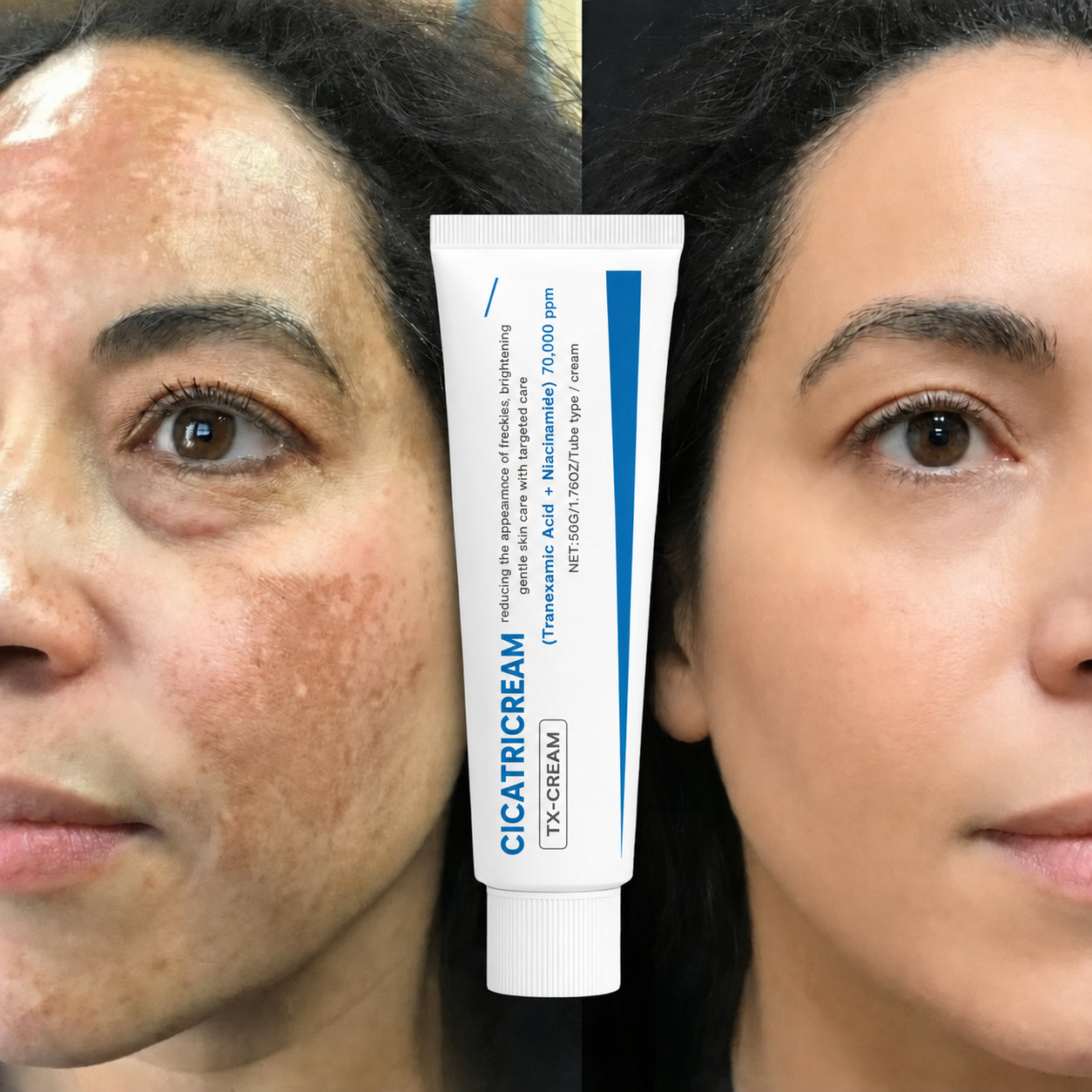 Cicatricream® Corrector de Manchas