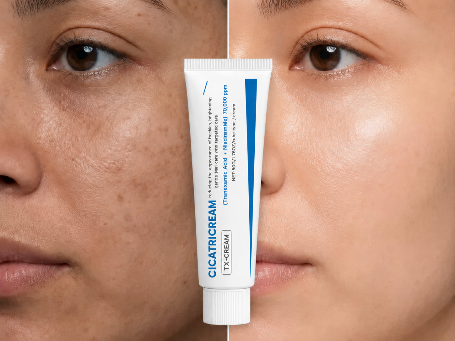 Cicatricream — corrector de manchas