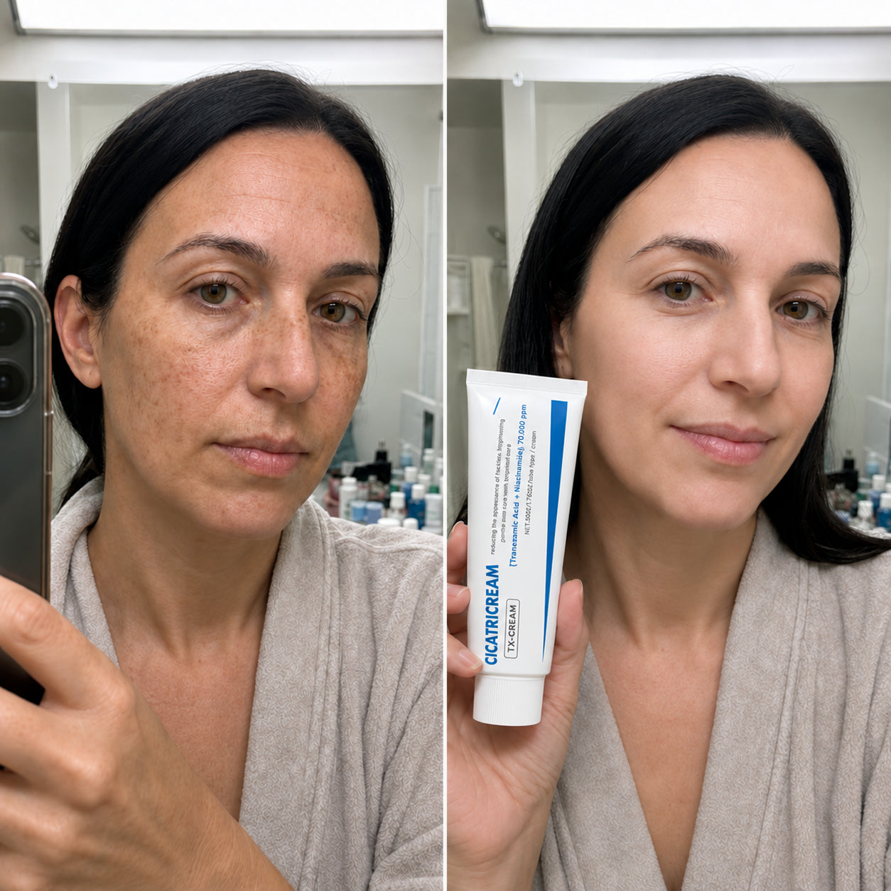 Cicatricream — corrector de manchas