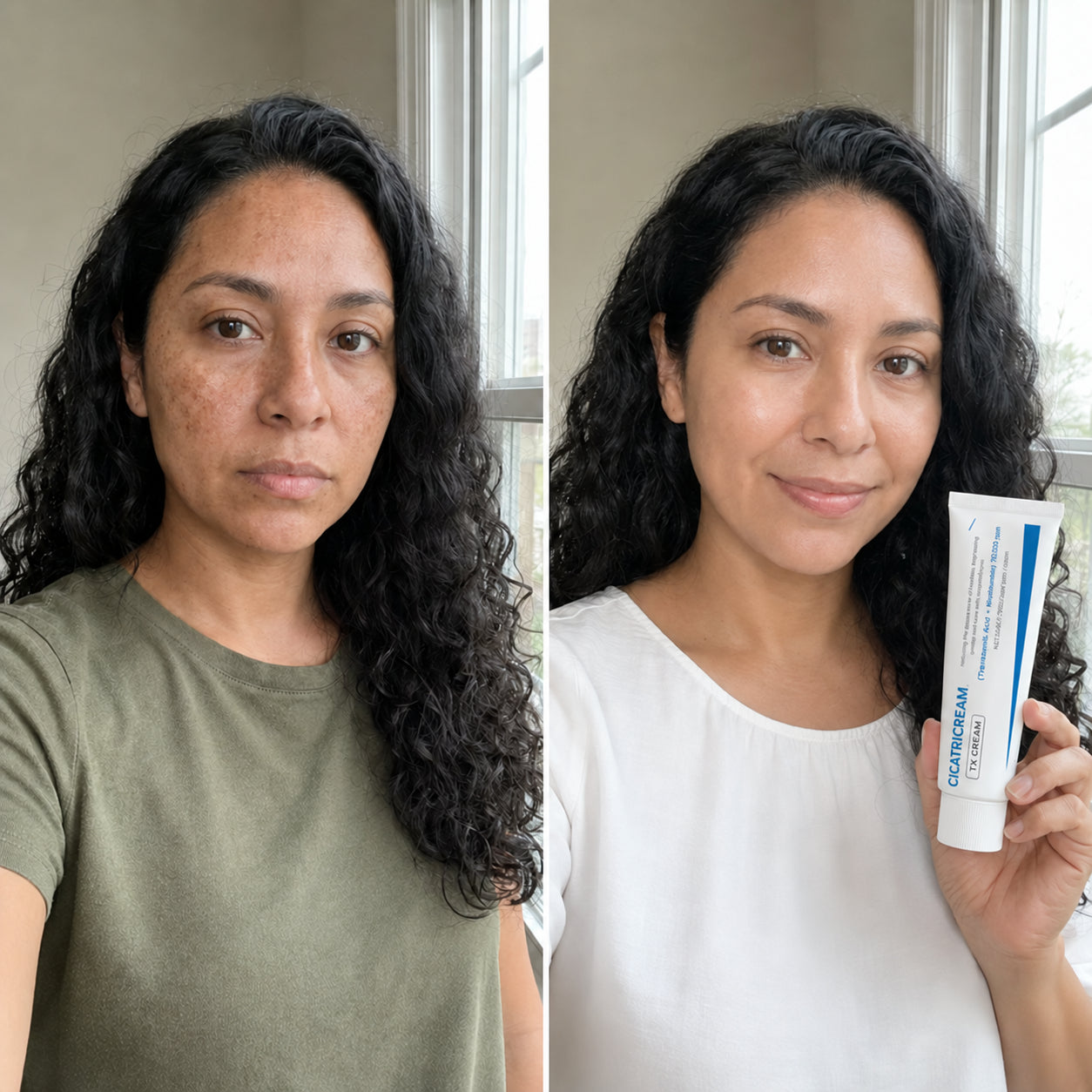 Cicatricream — corrector de manchas