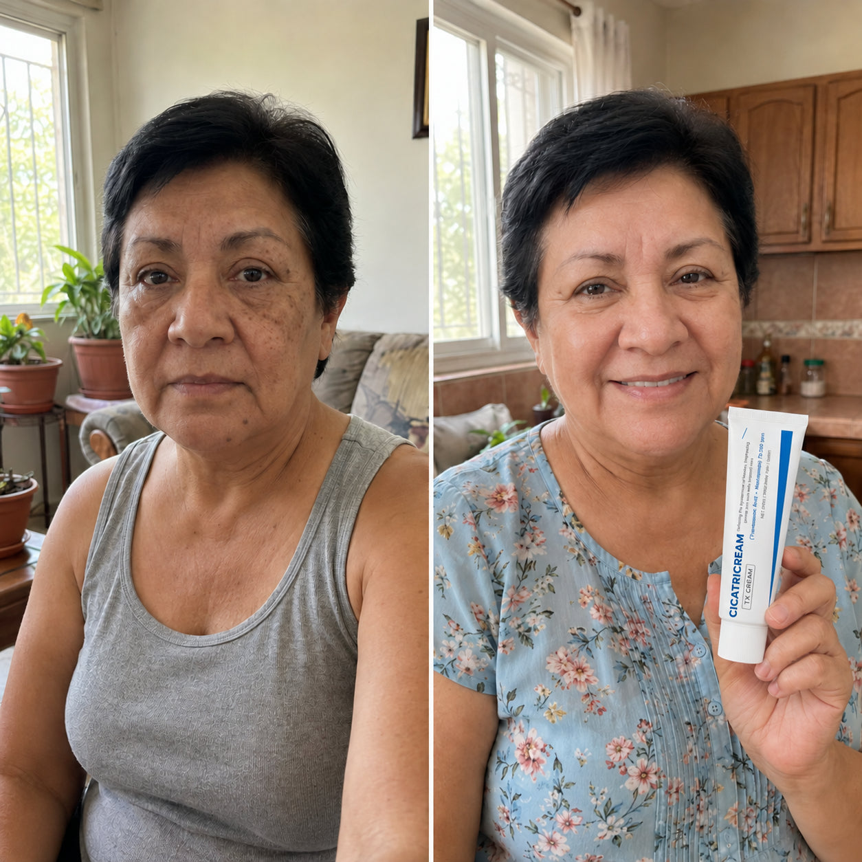 Cicatricream — corrector de manchas